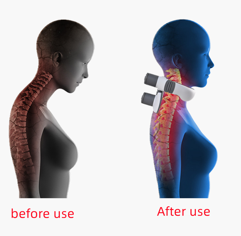 Massager Cervical Vertebra Massage| Cervical Vertebra Four Heads| Cervical Vertebra Massager